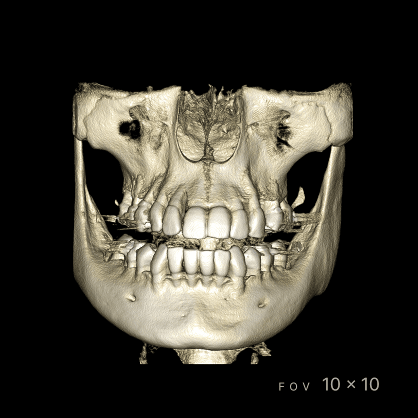 RAYSCAN Series - CBCT - Image 5