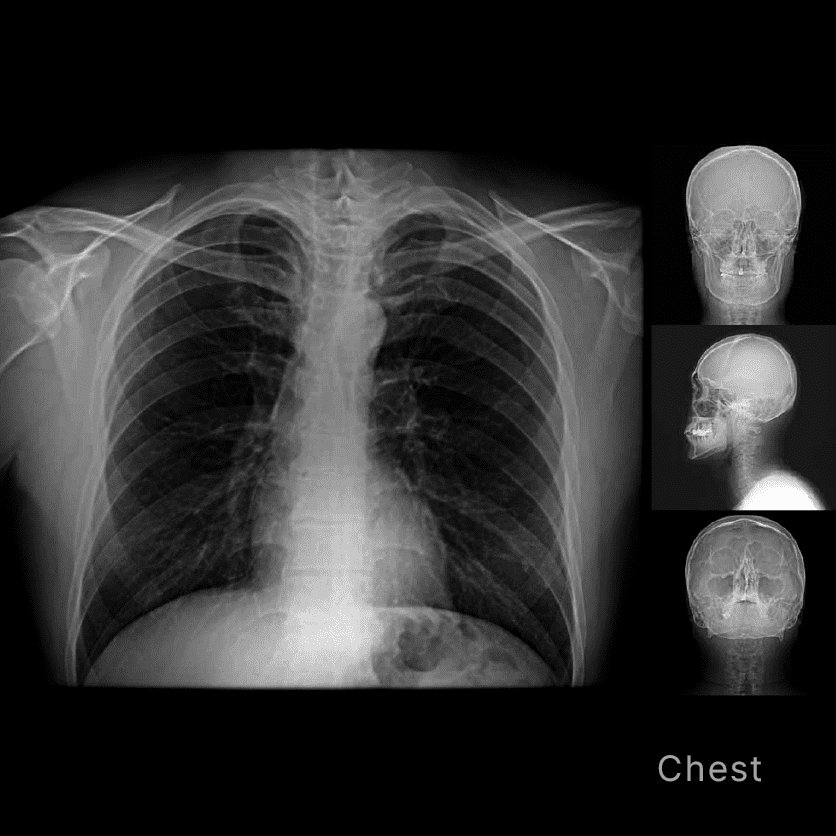 RAYSCAN Series - CBCT - Image 12