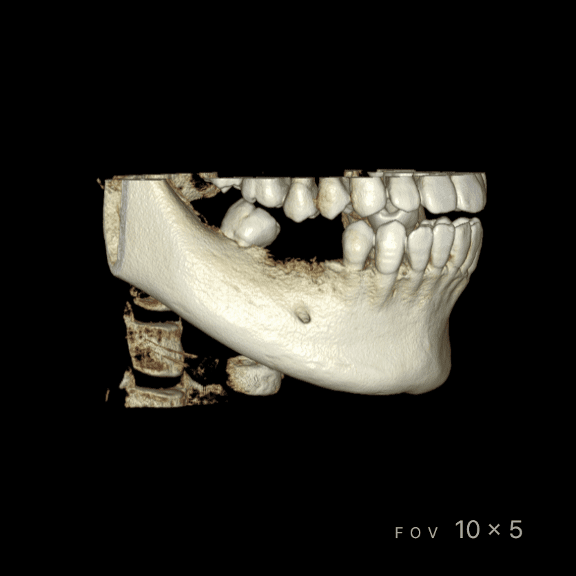 RAYSCAN Series - CBCT - Image 7