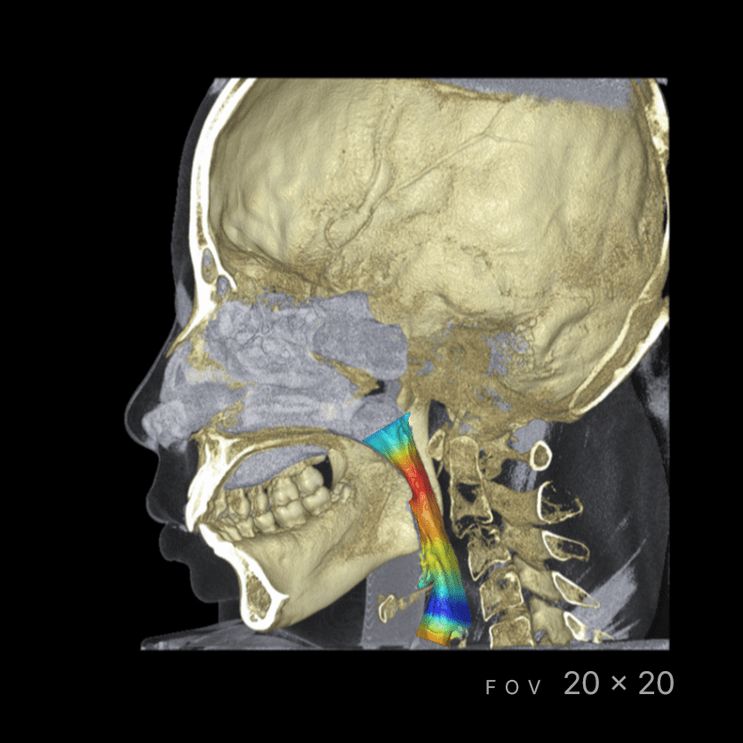 RAYSCAN Series - CBCT - Image 2