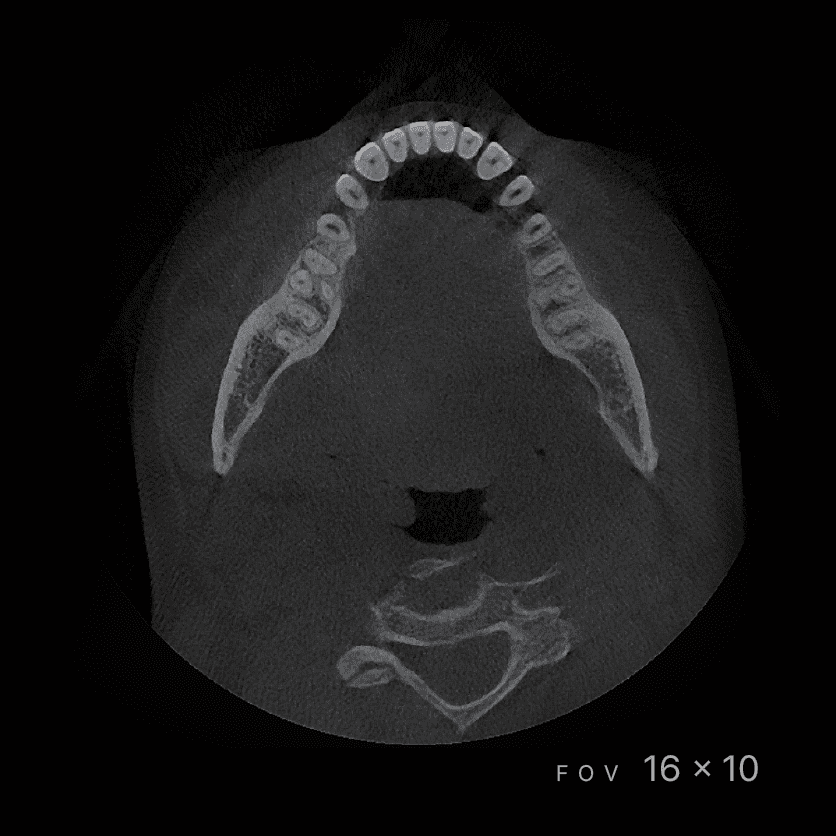 RAYSCAN Series - CBCT - Image 4