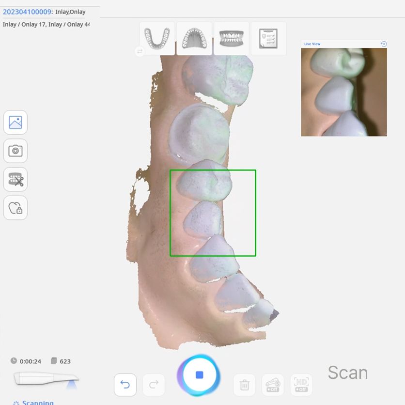 RAYIOS 2 - IOS - Image 2
