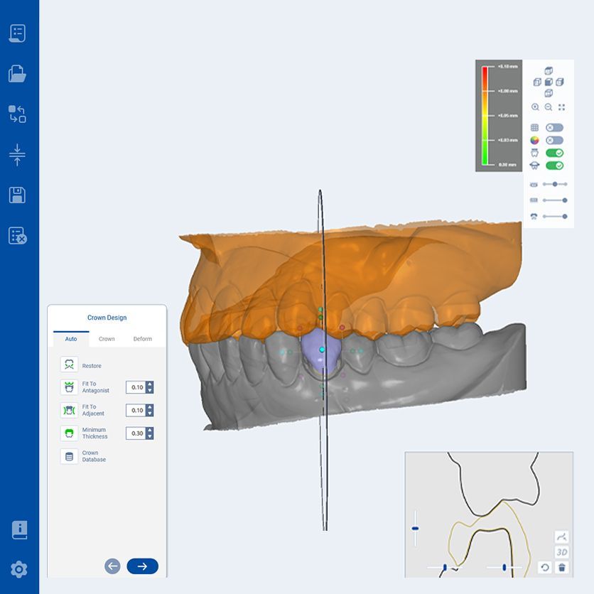RAYDENT Designer - Image 5