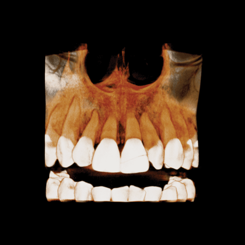 RAYPremiere - CBCT - Image 7