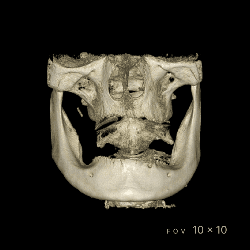 RAYSCAN Series - CBCT - Image 6