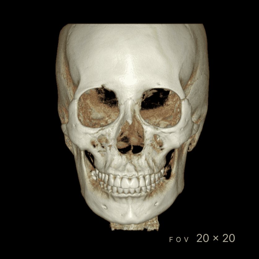 RAYSCAN Series - CBCT - Image 3