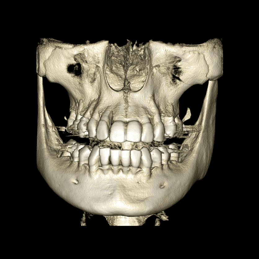 RAYPremiere - CBCT - Image 8