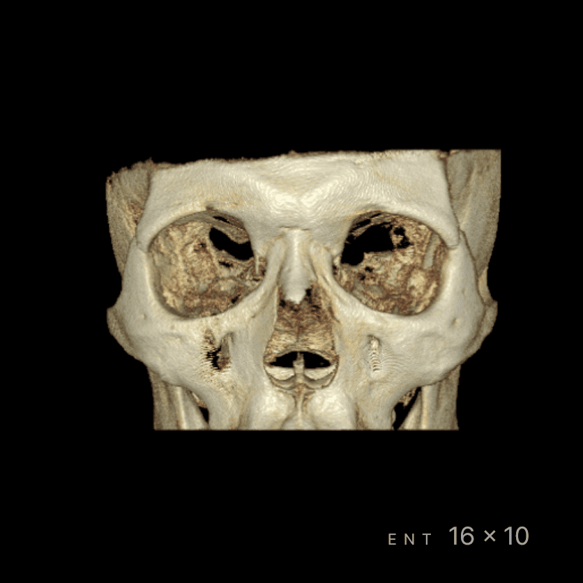 RAYSCAN Series - CBCT - Image 11