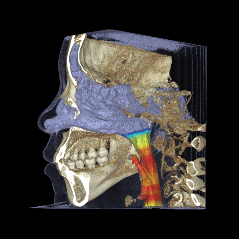 RAYPremiere - CBCT - Image 9
