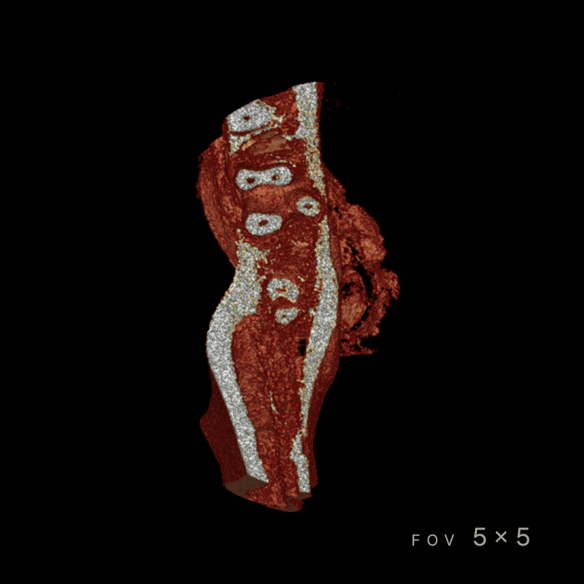 RAYSCAN Series - CBCT - Image 9