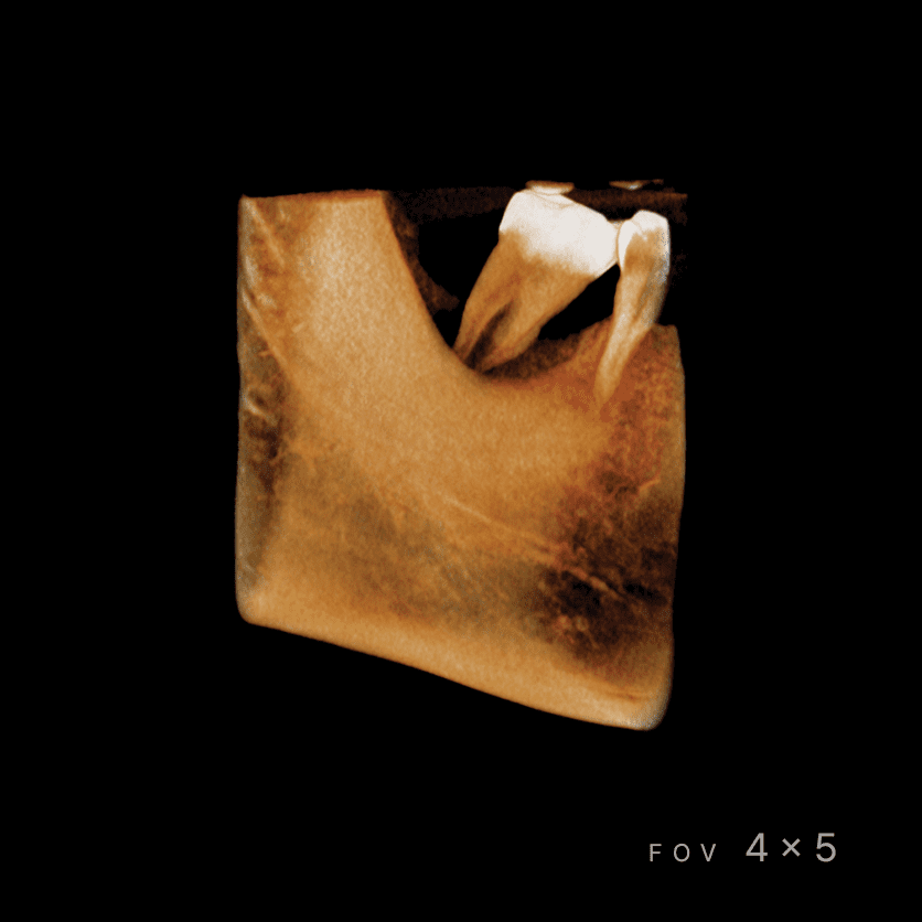 RAYSCAN Series - CBCT - Image 10