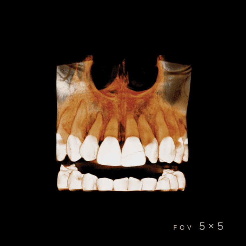 RAYSCAN Series - CBCT - Image 8