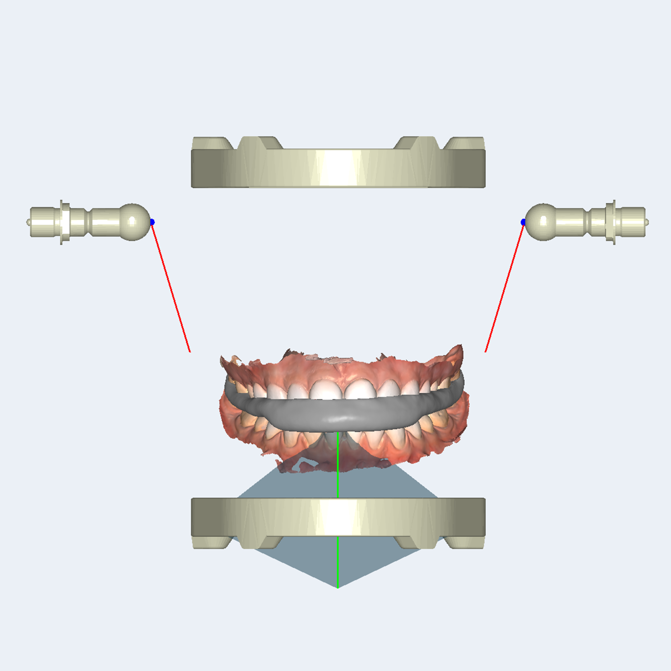 RAYDENT Splint - Image 6